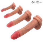 MR INTENSE Gary XL silikonowy model anatomiczny z przyssawką, progresywna średnica, 25,5 cm