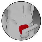 ElectraStim Silicone Fusion Viper pierścień e-stymulujący silikonowy, 6cm, dwukolorowy